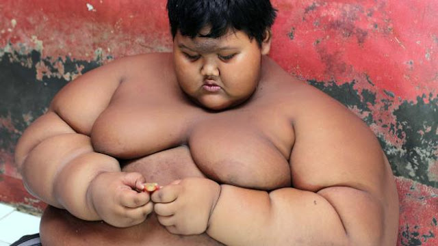 The world's fattest boy