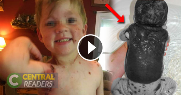 THIS MOM WAS SHOCKED WHEN SHE SAW HER NEWBORN WAS COVERED IN DARK, BLOODY SPOTS.