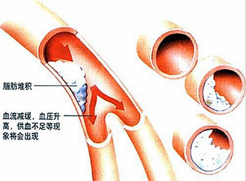 clip_image001