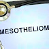 Mesothelioma Lawsuit After Death - Asbestos Exposure