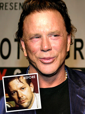 mickey rourke boxing. mickey rourke before plastic