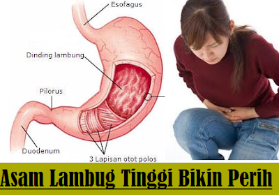 Bisakah Sinusitis Menyebabkan MAAG ?