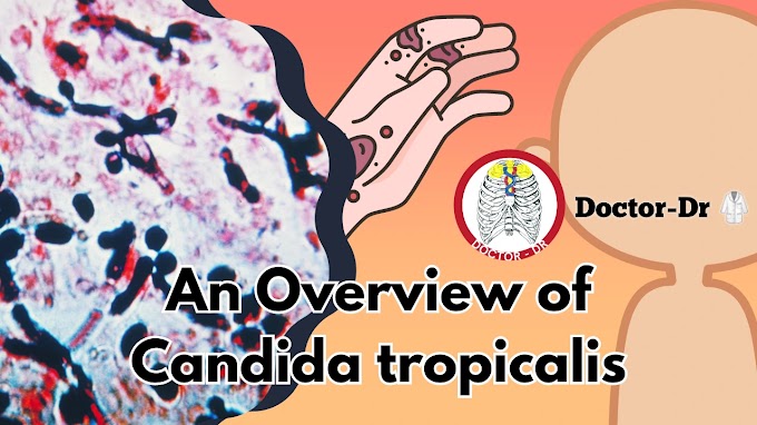 An Overview of Candida tropicalis