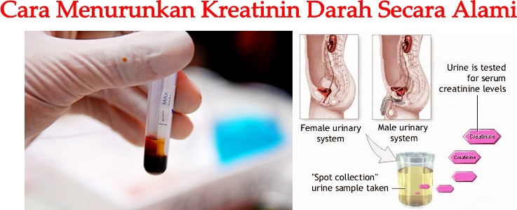 Obat Tradisional Menurunkan Kreatinin Darah