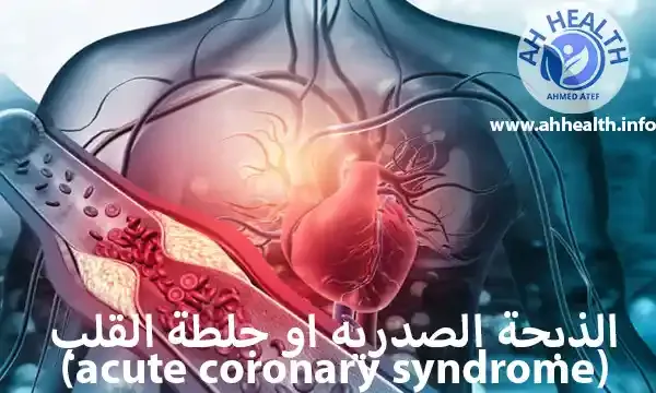الذبحة الصدريه او جلطة القلب  (acute coronary syndrome)