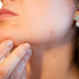 5 Clever Ways to Use Hydroquinone for Uneven Skin Tone