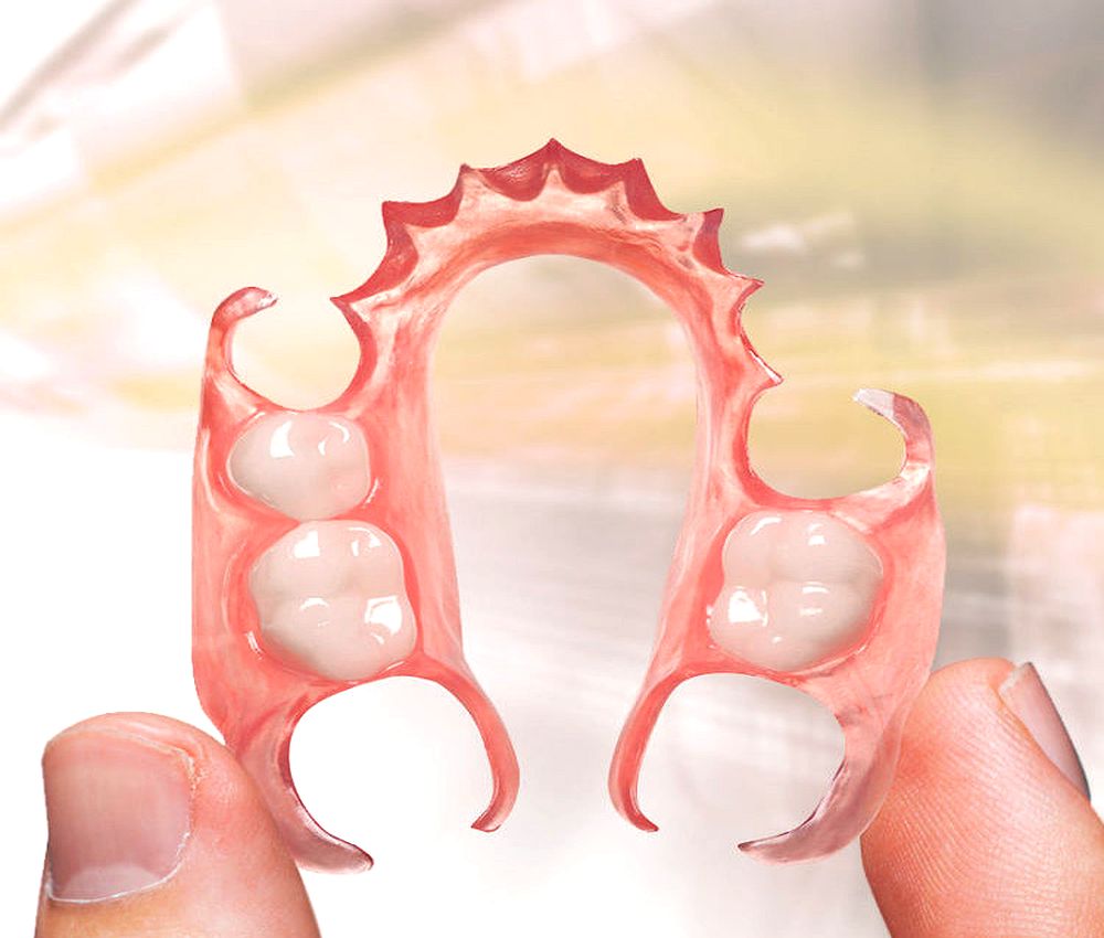 Dental Prostheses