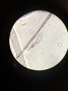 PARASITE