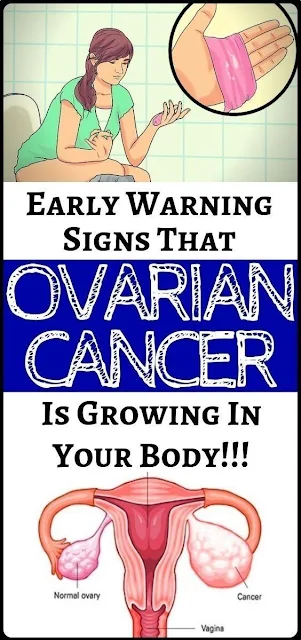 7 Signs Of Ovarian Cancer You Might Be Ignoring