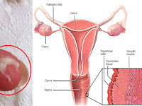 WANITA WAJIB TAU !! JIKA LAKI LAKI YANG BACA NYA SILAKAN DI TERUSKAN KE WANITA,  Inilah 8 Tanda Kalau Organ Pribadi Kamu Tidak Sehat! Segera Ketahui Gejalanya Sebelum Terlambat! 