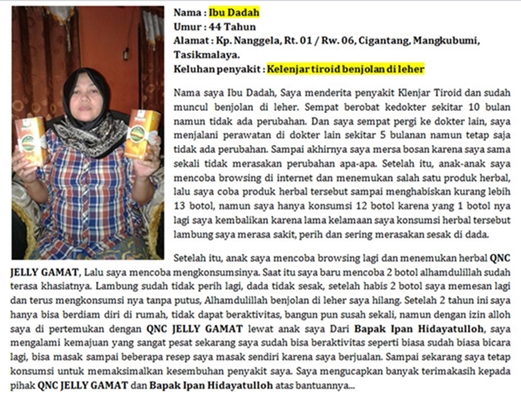 Obat Gondok Pada Wanita