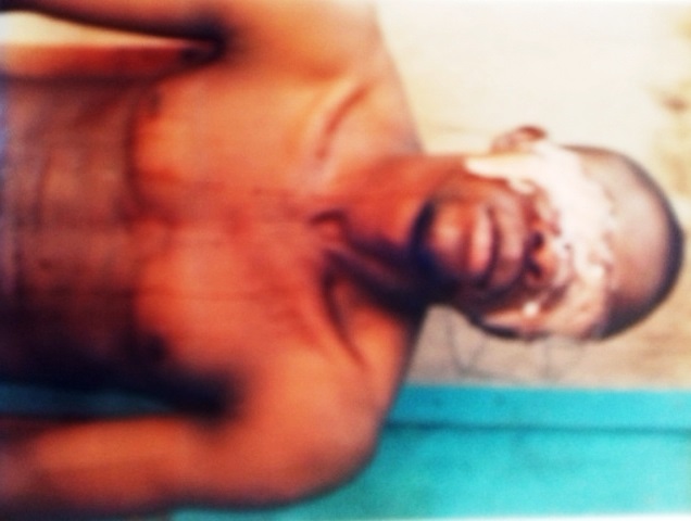 Victim of Police brutality rendered homeless, losses baby