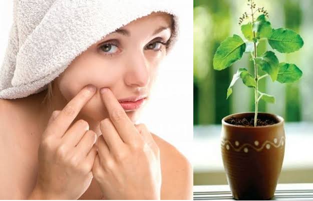 Tulsi Beauty Tips in Hindi For Pimples