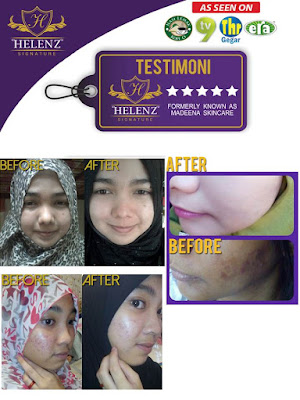 Testimoni Helenz Signature Produk Kecantikan Madeena Skincare Terbukti Berkesan