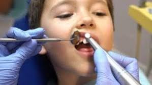 شاهد أفضل عيادات أسنان بجدة مجربة - Best dental clinic in Jeddah