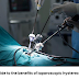A guide to the benefits of laparoscopic hysterectomy