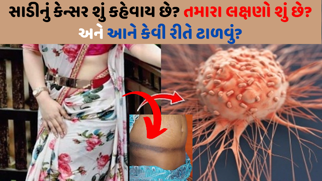 What is the disease called Saree Cancer?
