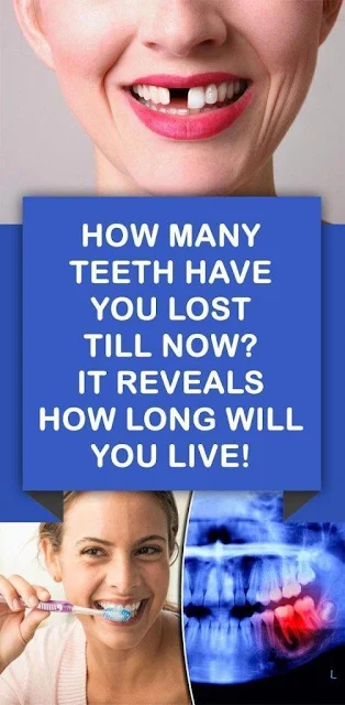 How Many Teeth Have You Lost So Far? It Tells You How Long You Will Live