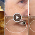 How To Remove Facial Wrinkles In 3 Days With 3 Ingredient Formula