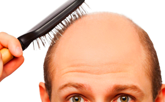 8 Manfaat Minyak Zaitun untuk Rambut dan cara penggunaannya