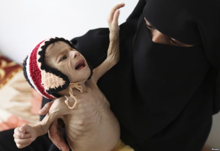 A Thousand Children Die Every Week As a Result of the US-Saudi War in Yemen