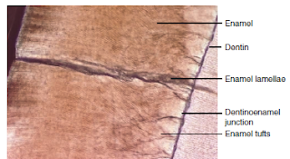 enamel lamellae