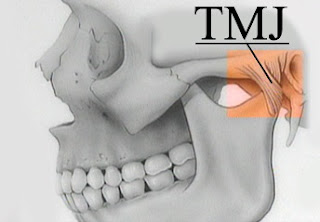 Seven Potential Examples Of TMJ Treatment