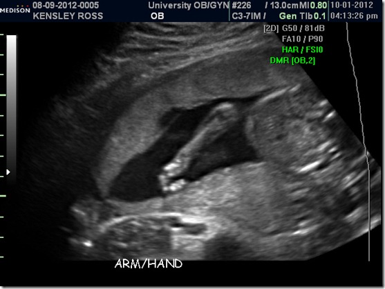 BABY BOY ROSS_9