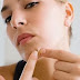 Acne: What It Is And How To Fight It