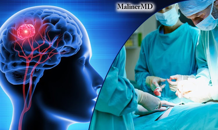 THINGS TO LOOK FOR BEFORE HIRING THE BEST NEUROLOGICAL SURGERY SPECIALIST