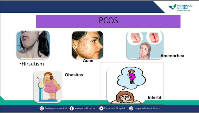 PCOS penyebab sulit hamil mayapada