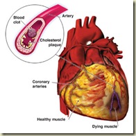 Cardiovascular.Disease