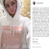 #freethepimple