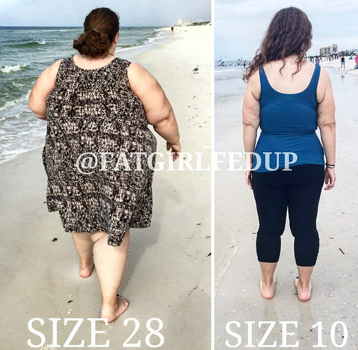 Incredible Before And After Pictures Of A Woman Who Used To Weigh 485lbs