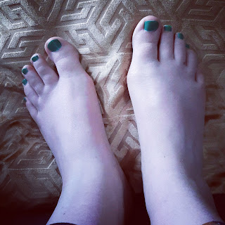 Pair of sore feet with green toenails on cushion.