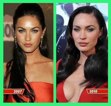 Megan Fox Before And After Plastic Surgery