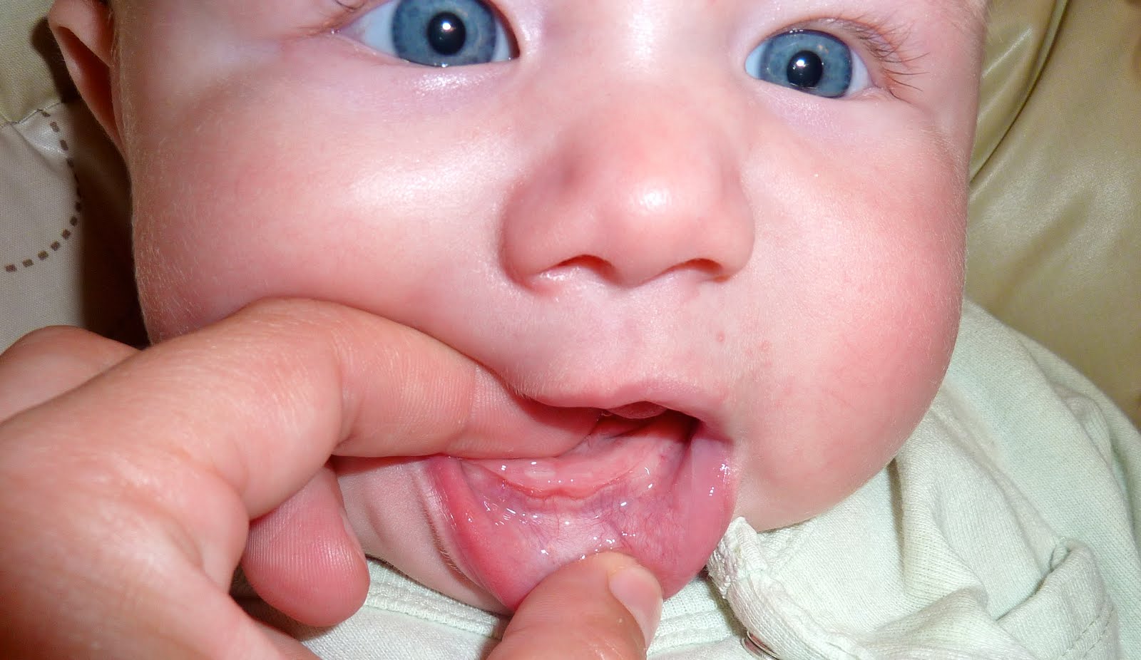 Teething question. - BabyGaga - Baby Has White Spots On Teeth