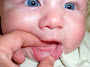 Baby Has White Spots On Teeth