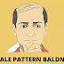 Male pattern baldness మగవారికి వంశపారంపర బట్టతల (మేల్ పాటర్న్ బల్డన్స్ ) 