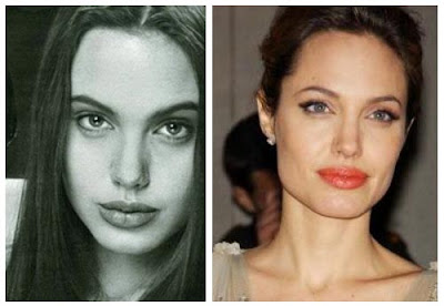 Angelina Jolie Nose Job