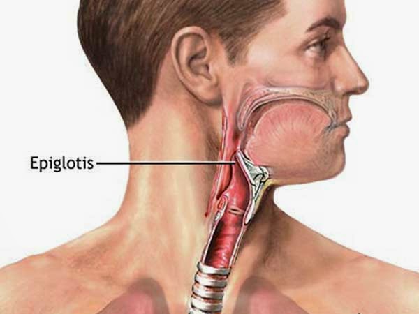 dolor en caso de epiglotitis