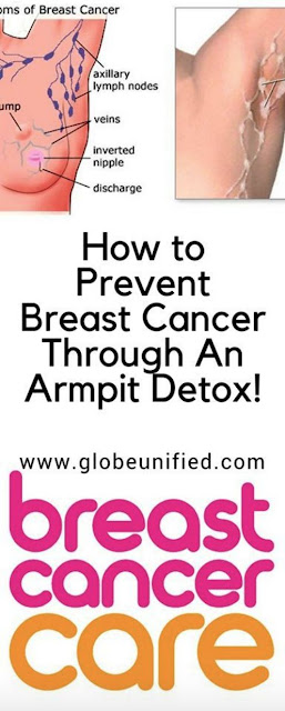 How to Prevent Breast Cancer Through An Armpit Detox!
