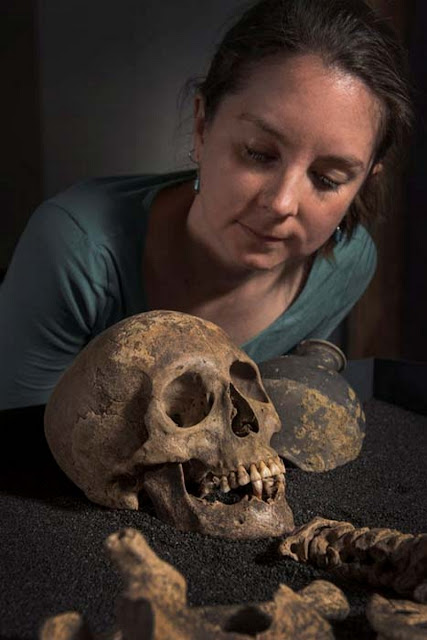 Череп женщины, похороненной в Саутварке (© Museum of London)