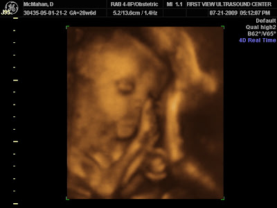 29 Weeks ~ 3D Ultrasound