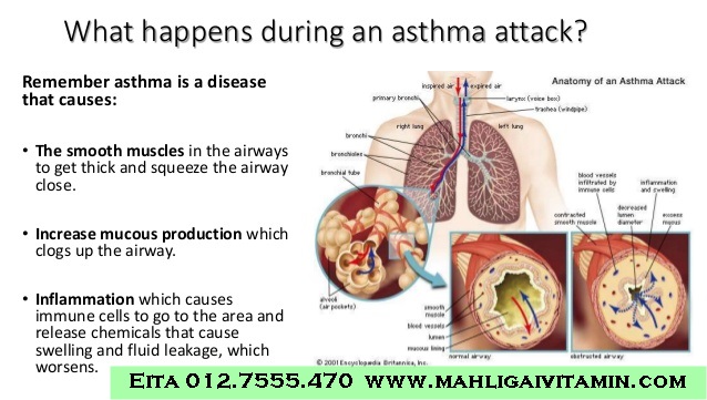 Apakah Ubat Penyakit Asthma @ Semput @ Lelah Selain 