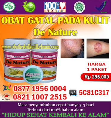 Obat Gatal Pada Kulit Tanpa Efek Samping