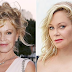 La búsqueda por retroceder el reloj: las celebridades de Hollywood que se desfiguraron el rostro con cirugías