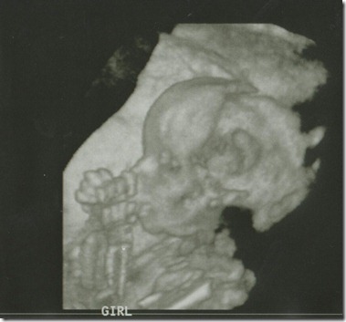 20 weeks 3d girl