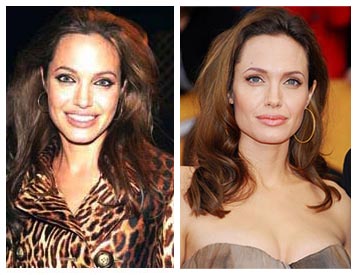 Angelina Jolie before and after rhinoplasty (nose job)? (http://plasticsurgerybeforeandafter.blogspot.com.es)