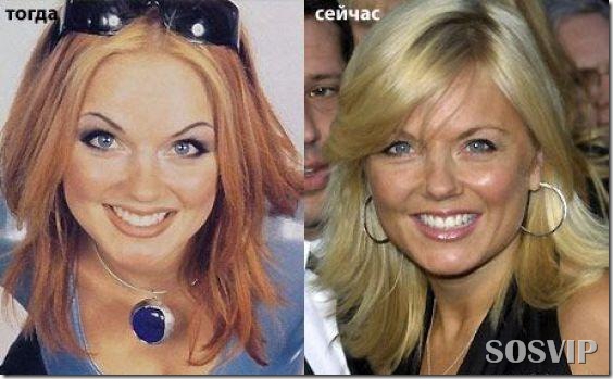 Celebridades antes e depois - Celebs before after.jpg (22)